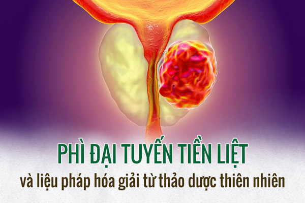 phi dai tien liet tuyen