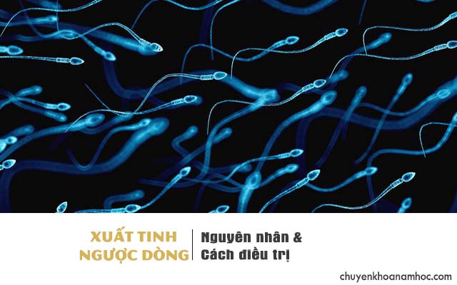 Xuất tinh ngược dòng