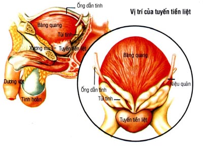 cach-phong-benh-viem-tuyen-tien-liet