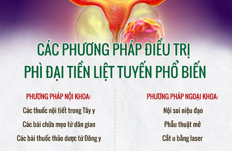 phi-dai-tien-liet-tuyen-11